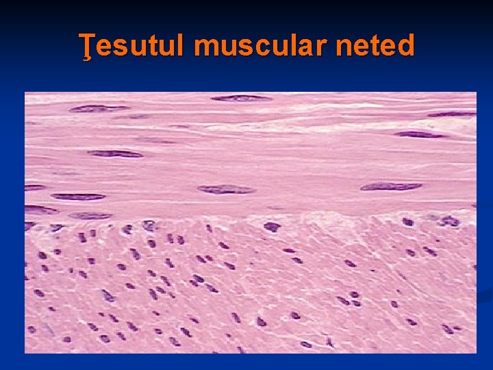 Ţesutul muscular neted 