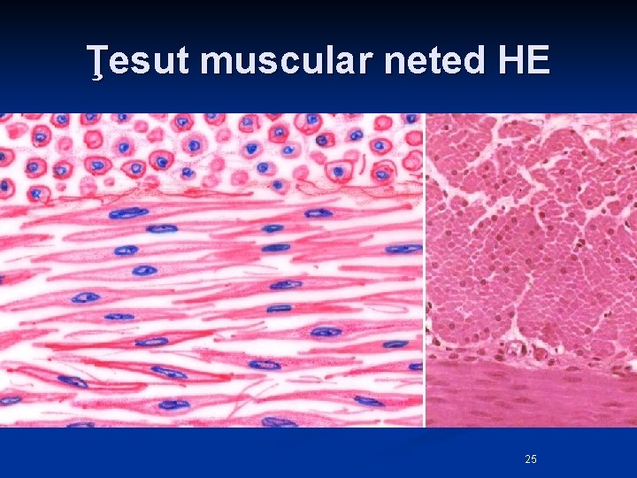 Ţesut muscular neted HE 25 