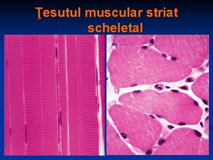 Ţesutul muscular striat scheletal 