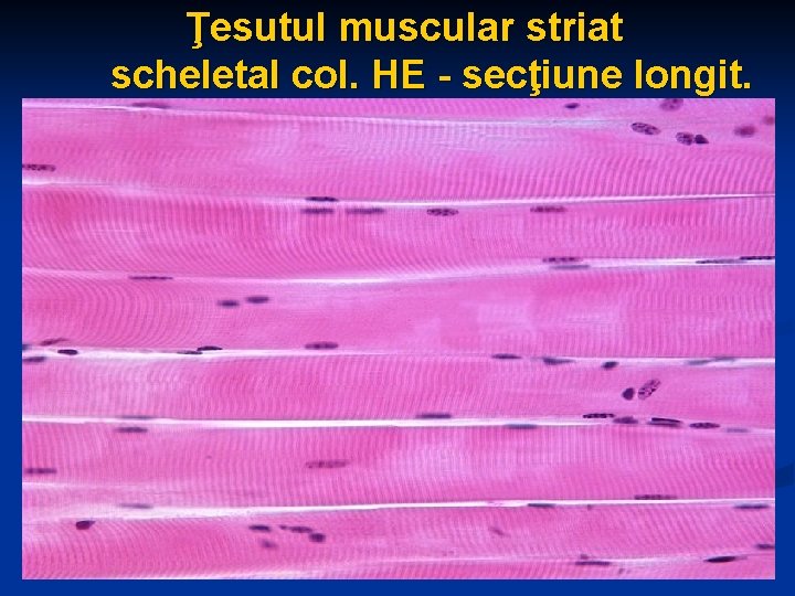 Ţesutul muscular striat scheletal col. HE - secţiune longit. 