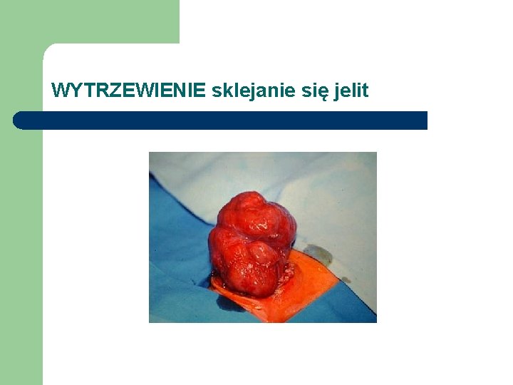 WYTRZEWIENIE sklejanie się jelit 