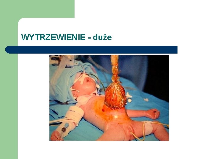 WYTRZEWIENIE - duże 