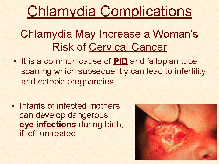 Chlamydia Complications Chlamydia May Increase a Woman's Risk of Cervical Cancer • It is
