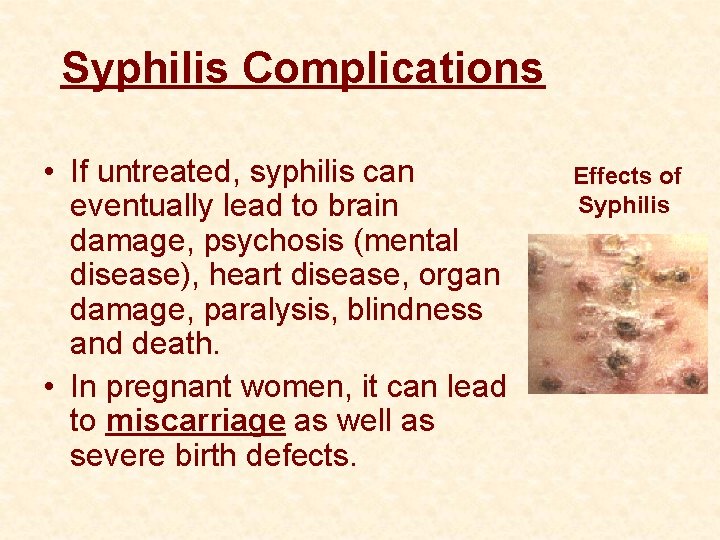 Syphilis Complications • If untreated, syphilis can eventually lead to brain damage, psychosis (mental
