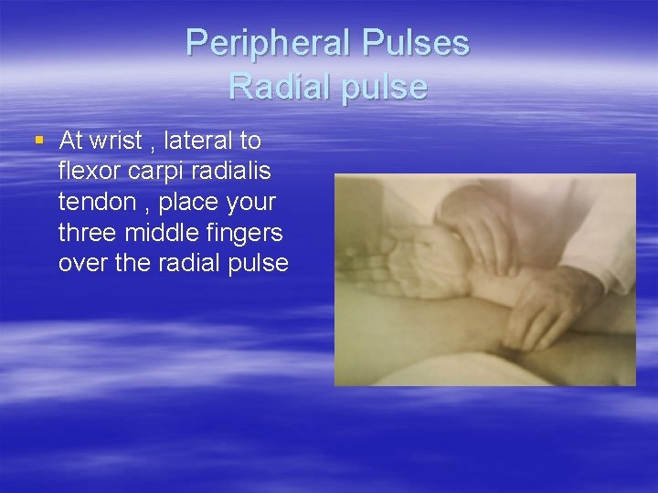 Peripheral Pulses Radial pulse § At wrist , lateral to flexor carpi radialis tendon