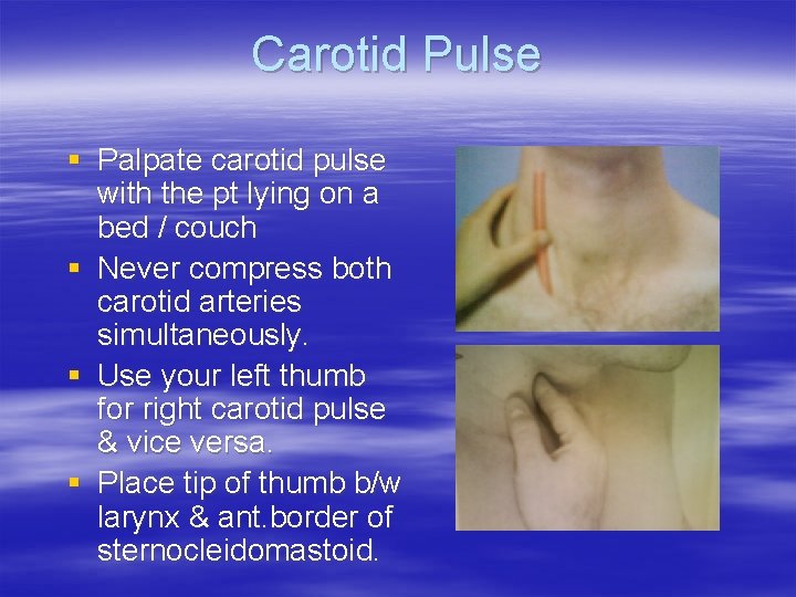 Carotid Pulse § Palpate carotid pulse with the pt lying on a bed /