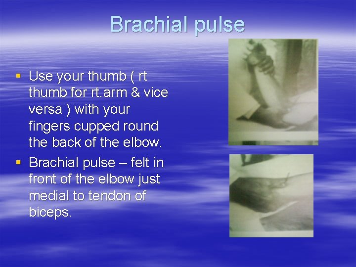 Brachial pulse § Use your thumb ( rt thumb for rt. arm & vice