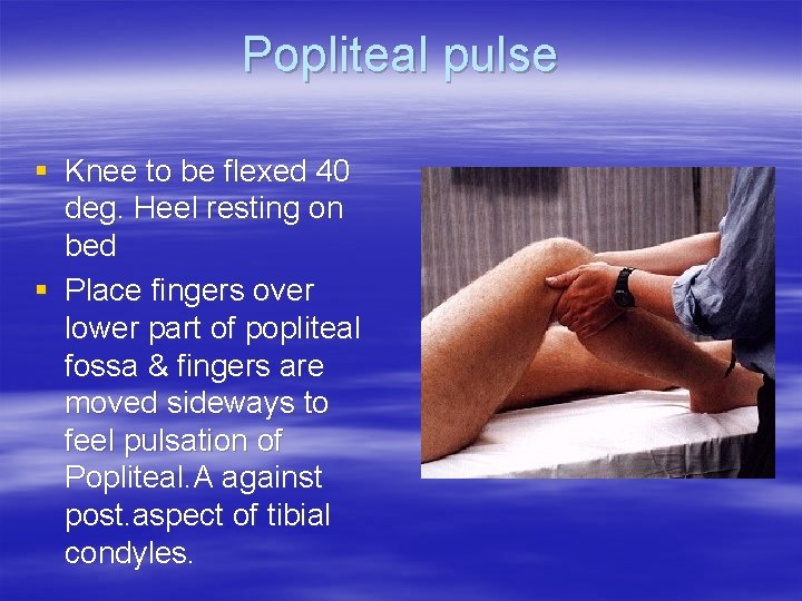 Popliteal pulse § Knee to be flexed 40 deg. Heel resting on bed §