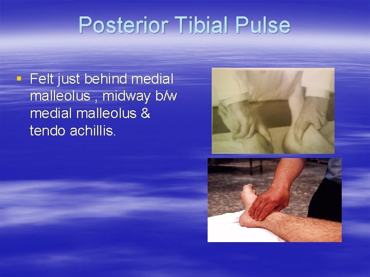 Posterior Tibial Pulse § Felt just behind medial malleolus , midway b/w medial malleolus