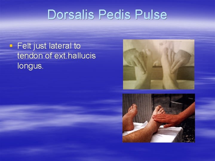 Dorsalis Pedis Pulse § Felt just lateral to tendon of ext. hallucis longus. 