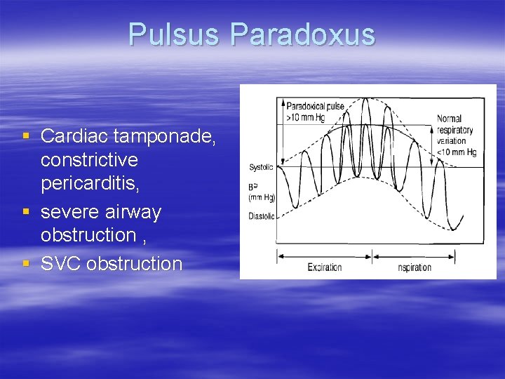 Pulsus Paradoxus § Cardiac tamponade, constrictive pericarditis, § severe airway obstruction , § SVC