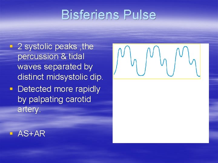 Bisferiens Pulse § 2 systolic peaks , the percussion & tidal waves separated by