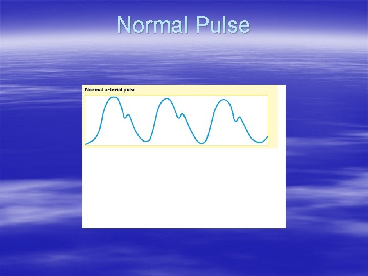 Normal Pulse 