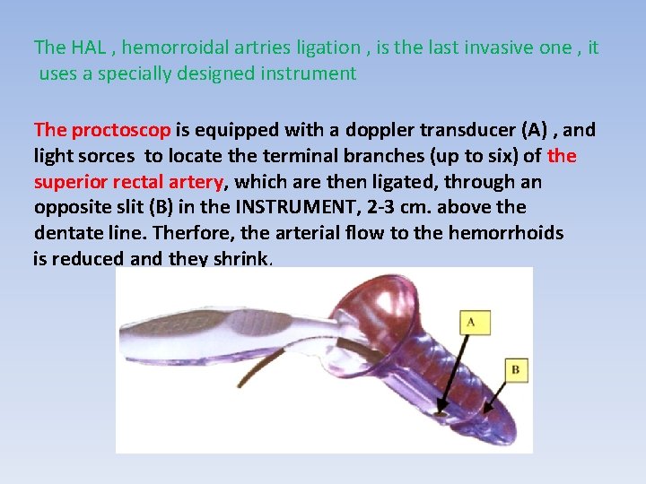 The HAL , hemorroidal artries ligation , is the last invasive one , it