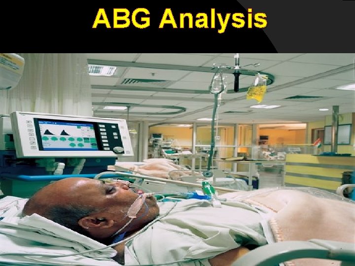 ABG Analysis . ABG Analysis .