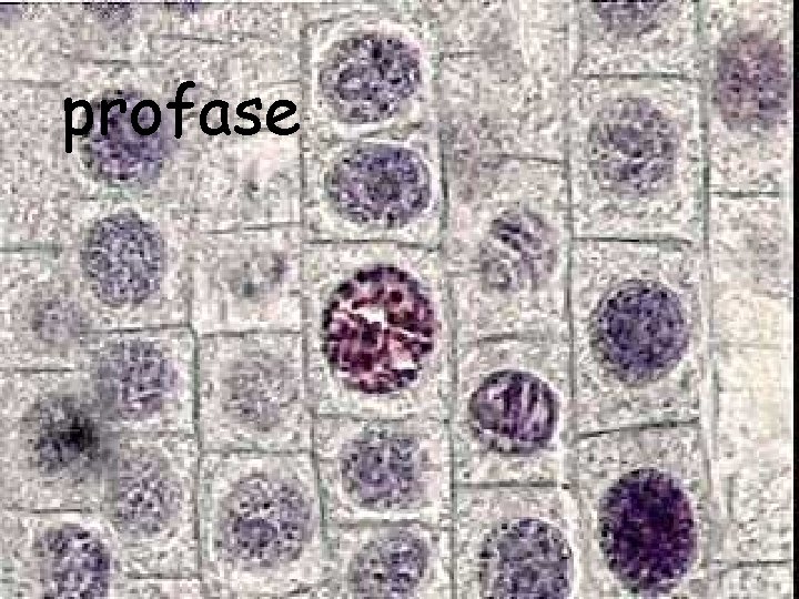 profase 