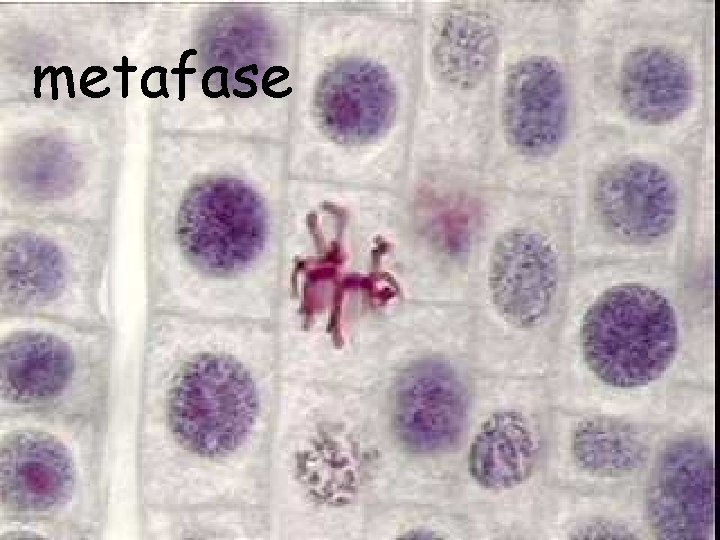 metafase 