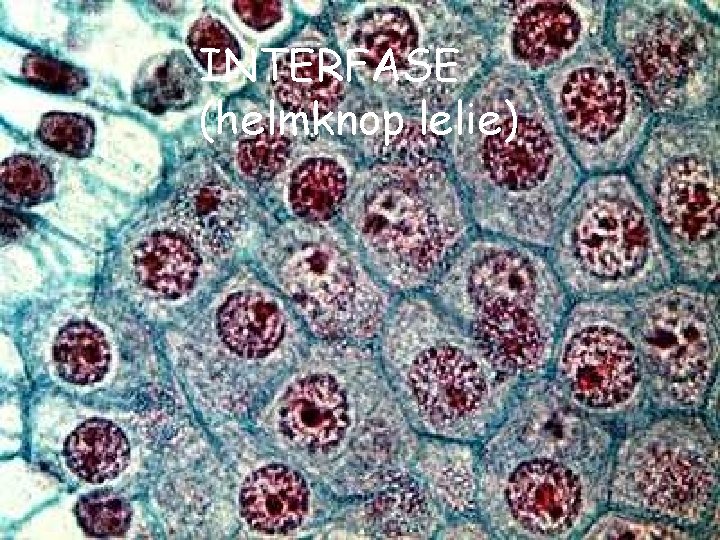 INTERFASE (helmknop lelie) 