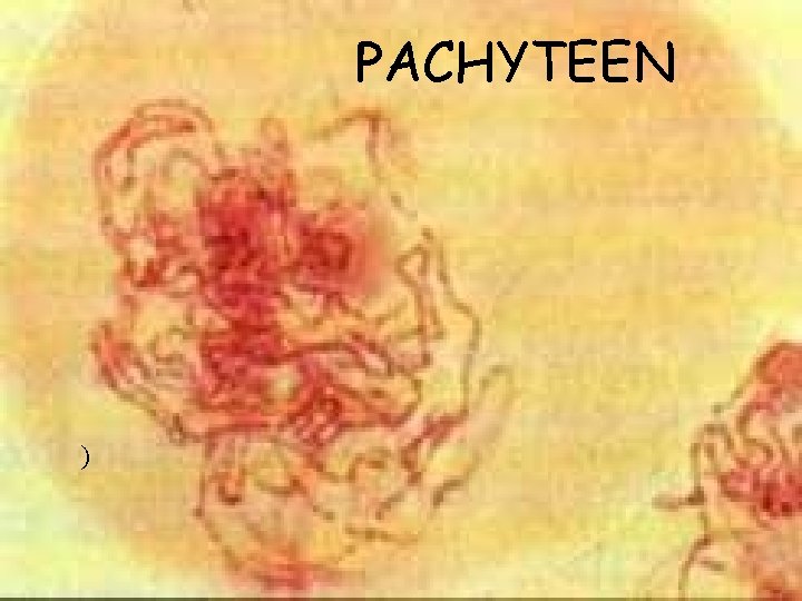 PACHYTEEN ) 