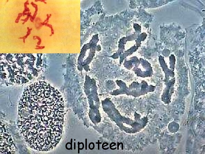 diploteen 