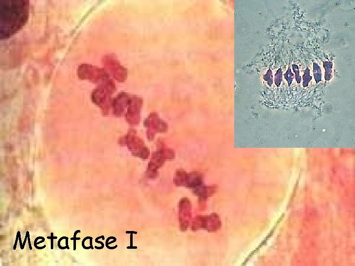 Metafase I 