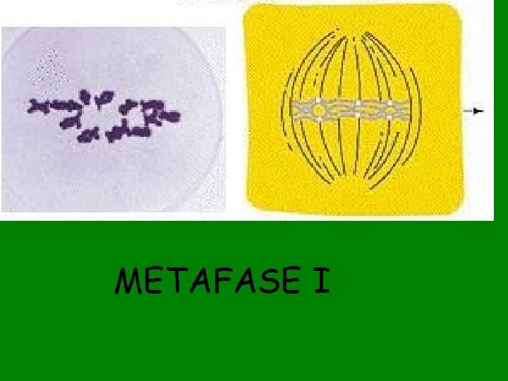 METAFASE I 
