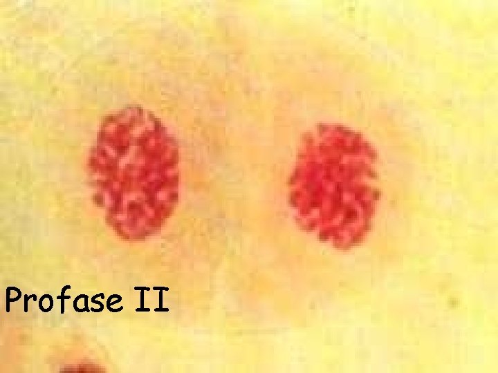 Profase II 