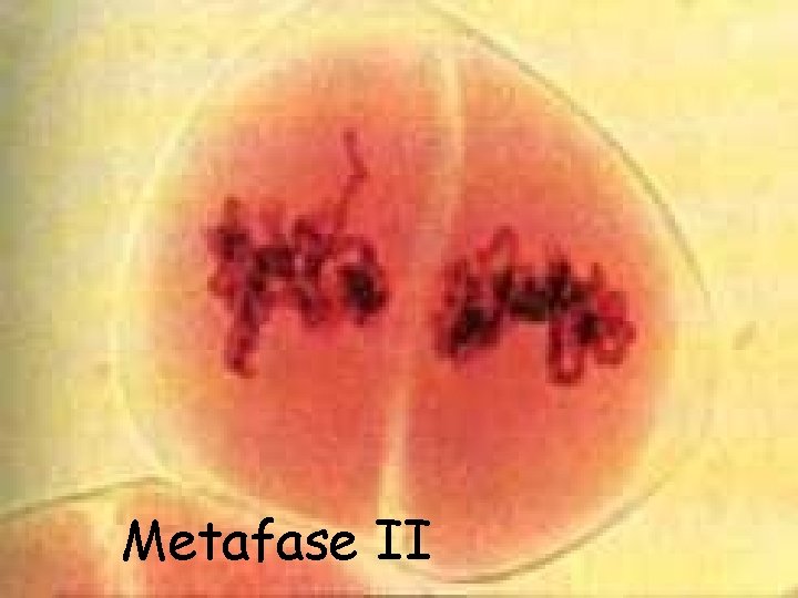 Metafase II 