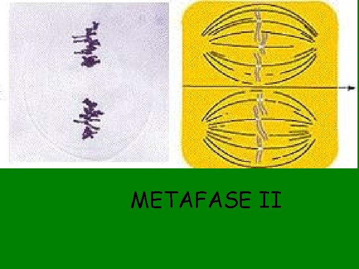 METAFASE II 