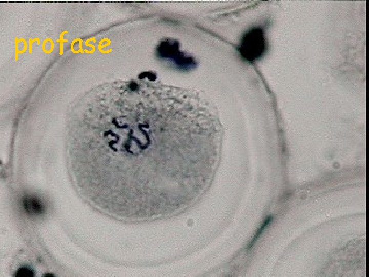 profase 