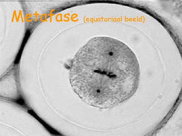 Metafase (equatoriaal beeld) 
