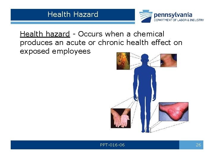 Health Hazard Health hazard - Occurs when a chemical produces an acute or chronic Health Hazard Health hazard - Occurs when a chemical produces an acute or chronic