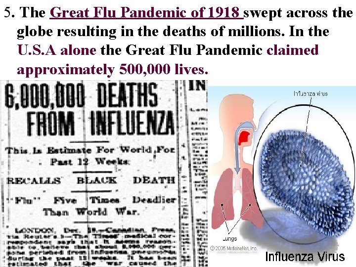 5. The Great Flu Pandemic of 1918 swept across the globe resulting in the