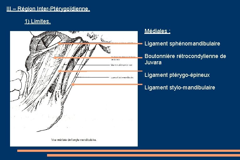 III – Région Inter-Ptérygoïdienne. 1) Limites. Médiales : Ligament sphénomandibulaire Boutonnière rétrocondylienne de Juvara