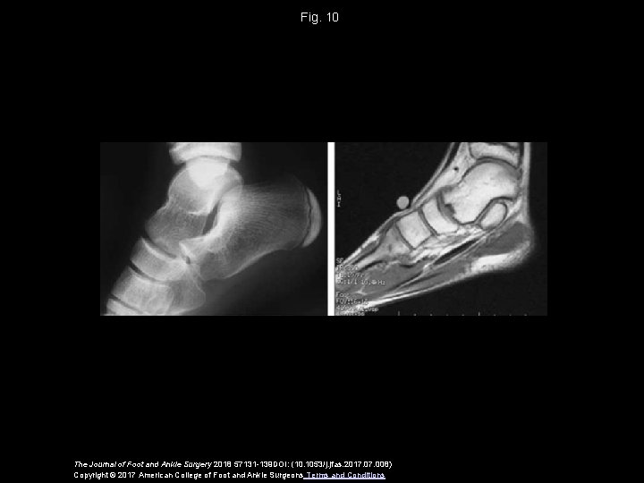 Fig. 10 The Journal of Foot and Ankle Surgery 2018 57131 -139 DOI: (10.