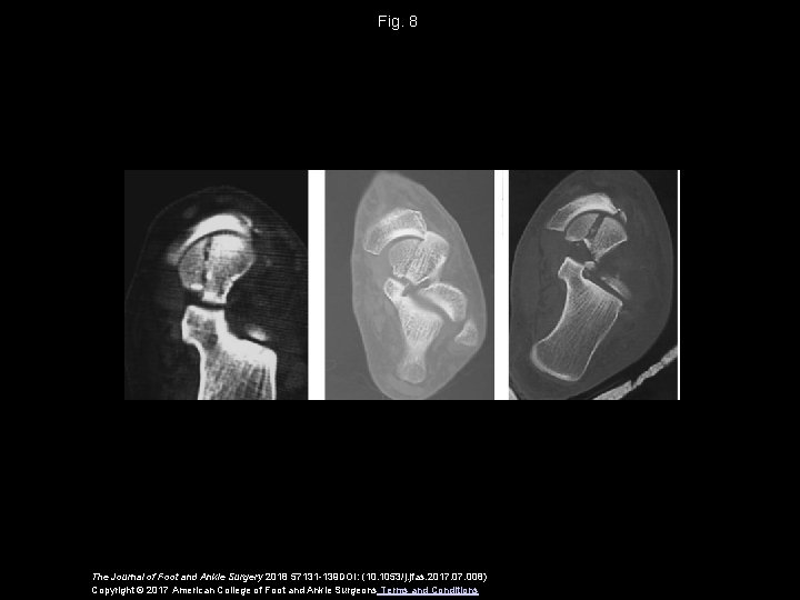 Fig. 8 The Journal of Foot and Ankle Surgery 2018 57131 -139 DOI: (10.