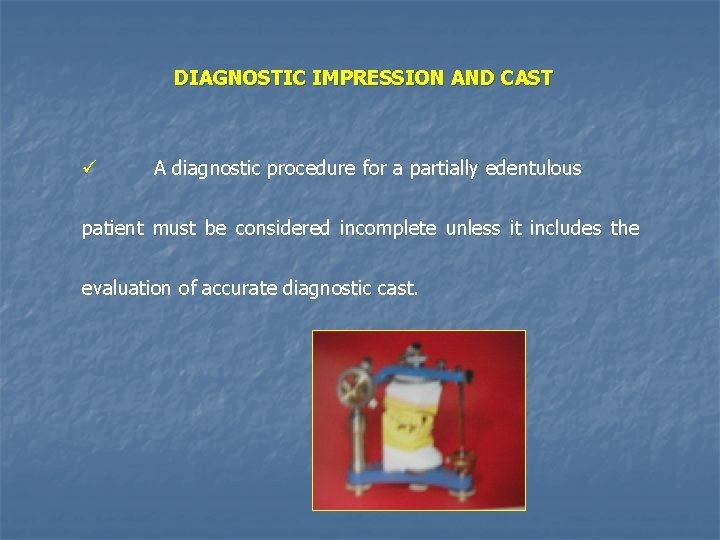 DIAGNOSTIC IMPRESSION AND CAST ü A diagnostic procedure for a partially edentulous patient must