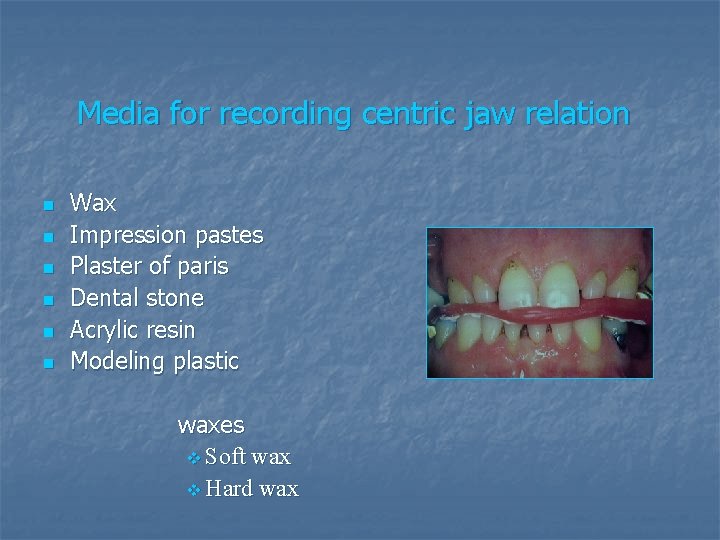 Media for recording centric jaw relation n n n Wax Impression pastes Plaster of