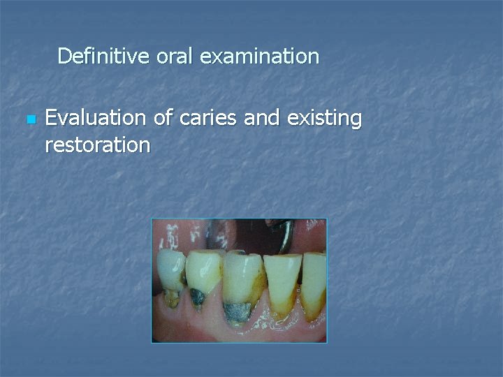 Definitive oral examination n Evaluation of caries and existing restoration 