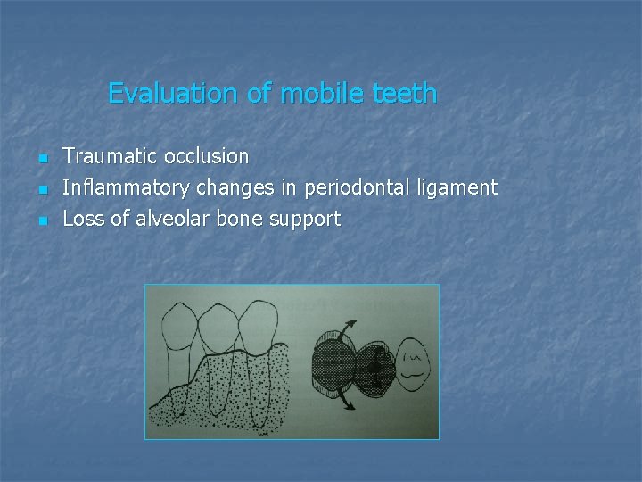 Evaluation of mobile teeth n n n Traumatic occlusion Inflammatory changes in periodontal ligament