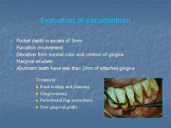 Evaluation of periodontium n n n Pocket depth in excess of 3 mm Furcation