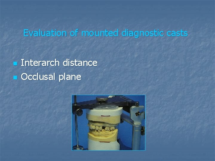 Evaluation of mounted diagnostic casts n n Interarch distance Occlusal plane 