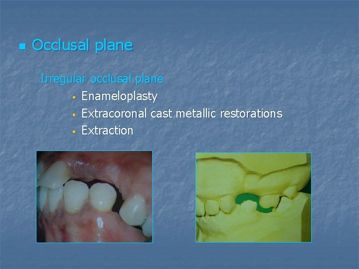 n Occlusal plane Irregular occlusal plane • Enameloplasty • Extracoronal cast metallic restorations •