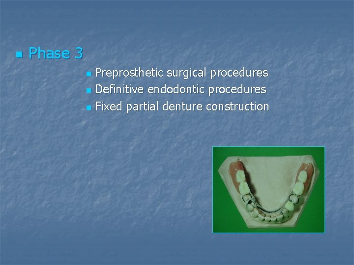 n Phase 3 Preprosthetic surgical procedures n Definitive endodontic procedures n Fixed partial denture