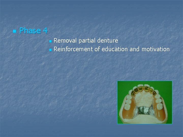 n Phase 4 Removal partial denture n Reinforcement of education and motivation n 