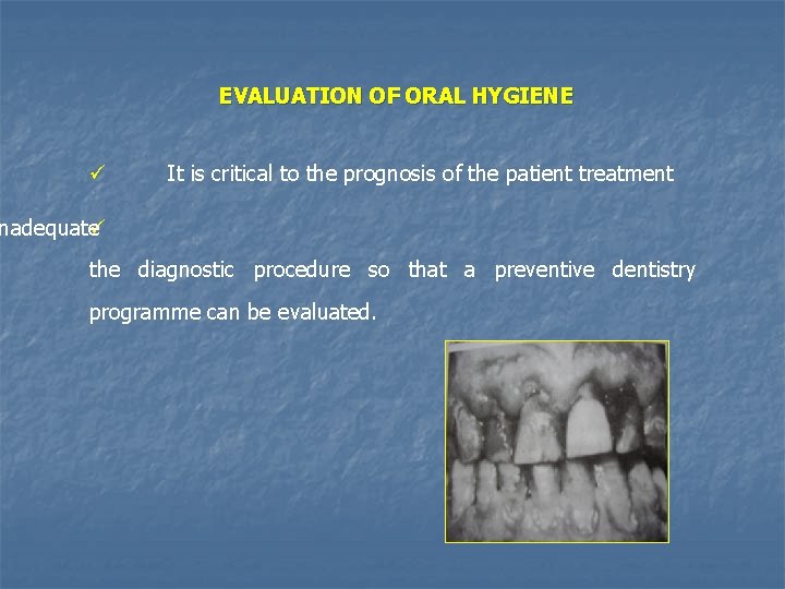 EVALUATION OF ORAL HYGIENE ü It is critical to the prognosis of the patient