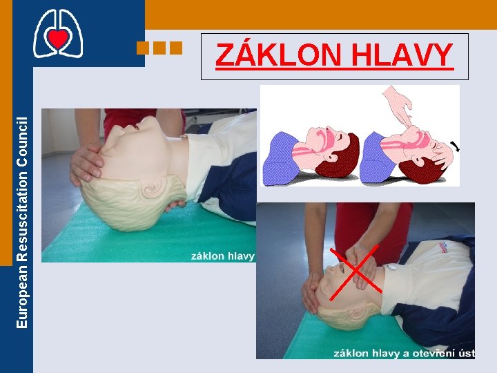 European Resuscitation Council ZÁKLON HLAVY European Resuscitation Council ZÁKLON HLAVY