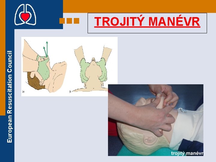European Resuscitation Council TROJITÝ MANÉVR European Resuscitation Council TROJITÝ MANÉVR