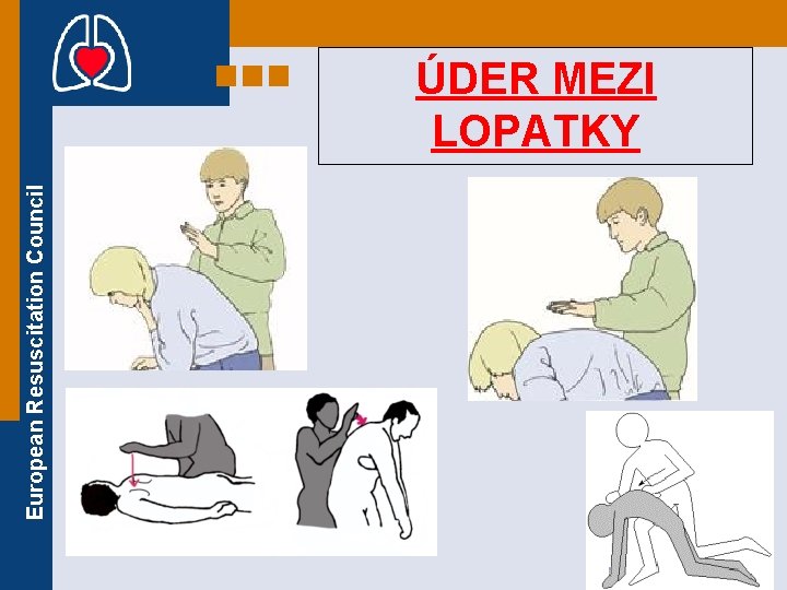 European Resuscitation Council ÚDER MEZI LOPATKY 