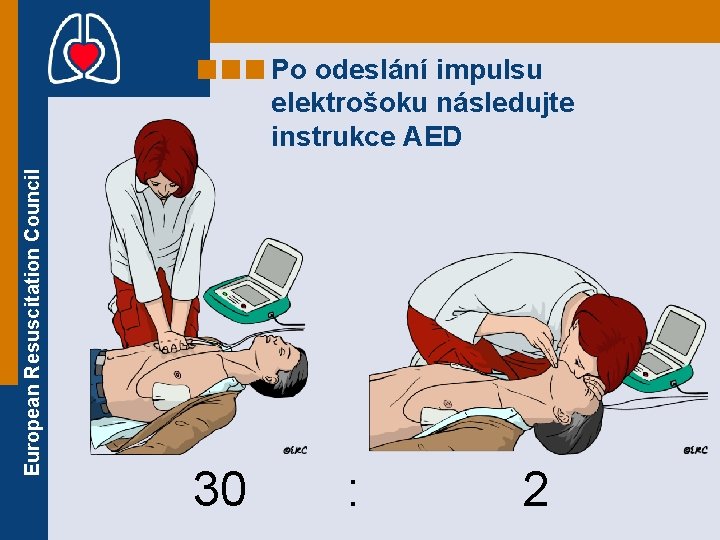European Resuscitation Council Po odeslání impulsu elektrošoku následujte instrukce AED 30 : 2 